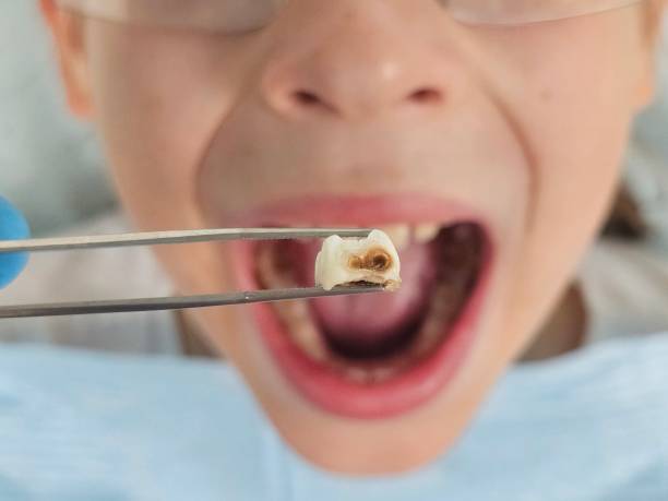 Best Emergency Treatment for Toothache in Valley Center, KS